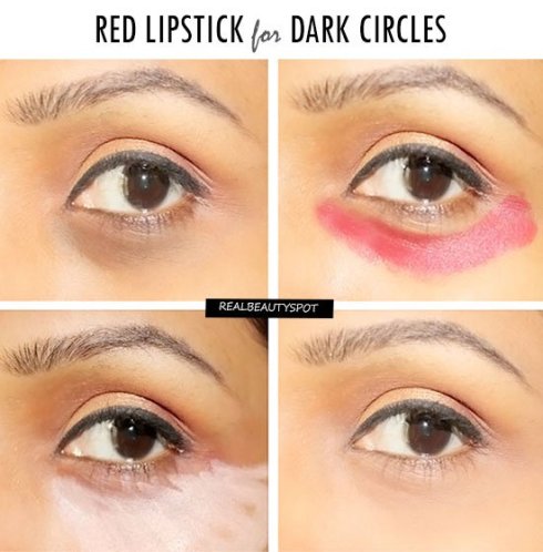 how to treat dark circles under eyes